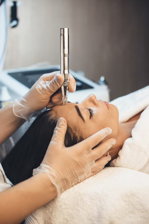 Dermal Fillers